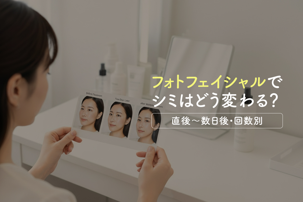 フォトフェイシャルでシミはどう変わる？写真で見る施術経過と見え方【直後〜数日後・回数別】