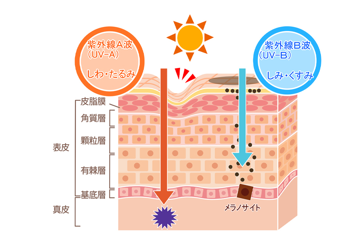 紫外線によるダメージを肌の断面図で示したイラスト。UVAは真皮層にまでダメージを与え、皮膚の表面にしわやたるみを作る。UVBは表皮の基底層のメラノサイトを刺激してメラニンを生成させ、有棘層・顆粒層・角質層と積み重なることで肌の表面にしみやくすみを作っている。