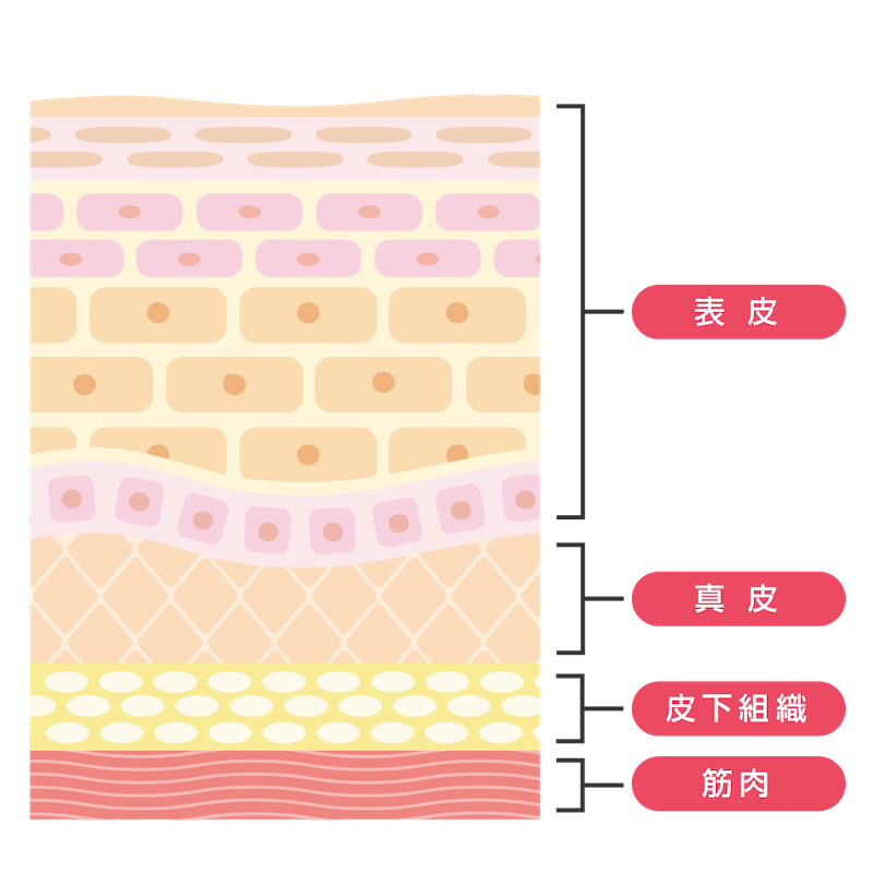 ダーマペン4のダウンタイムは何日続く？ダーマペン4のダウンタイム症状と対策について解説