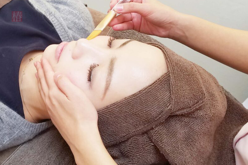 ケミカルピーリングはどんな治療？