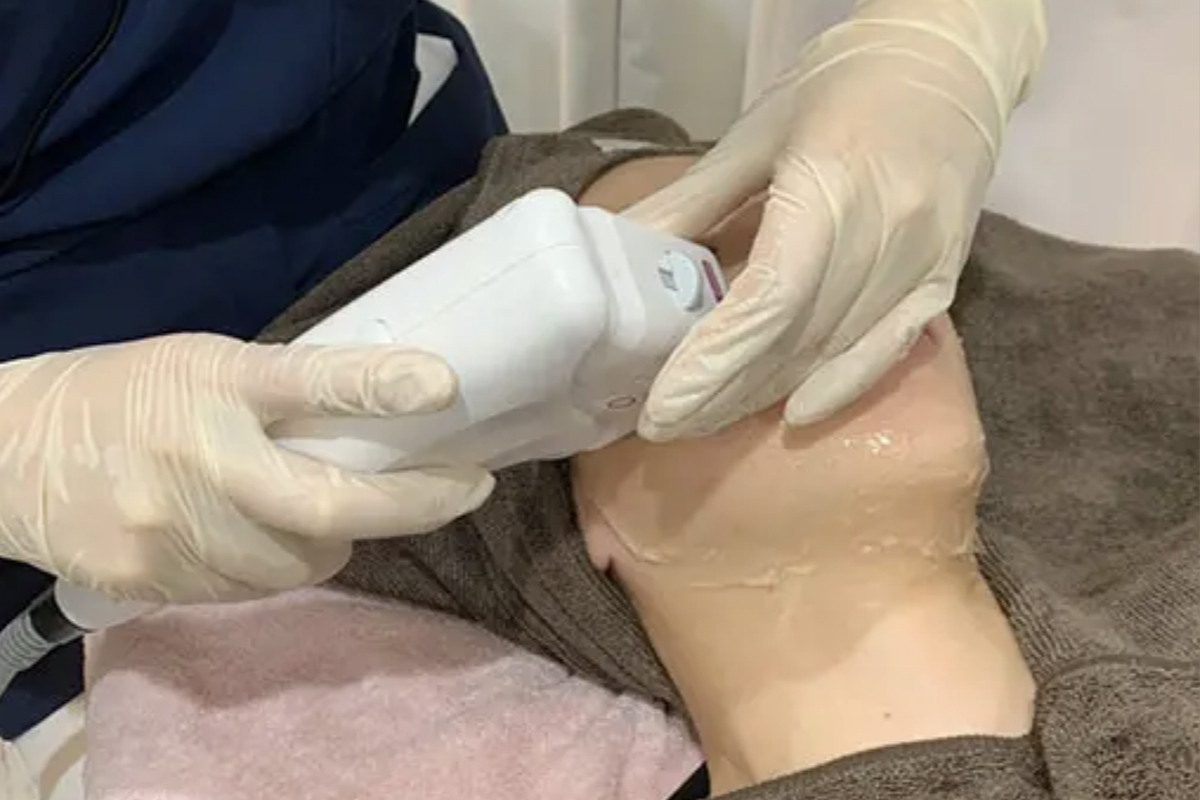 椿クリニックのベッドに横になり、クリニックのスタッフから医療ハイフの施術を受けている女性の写真です