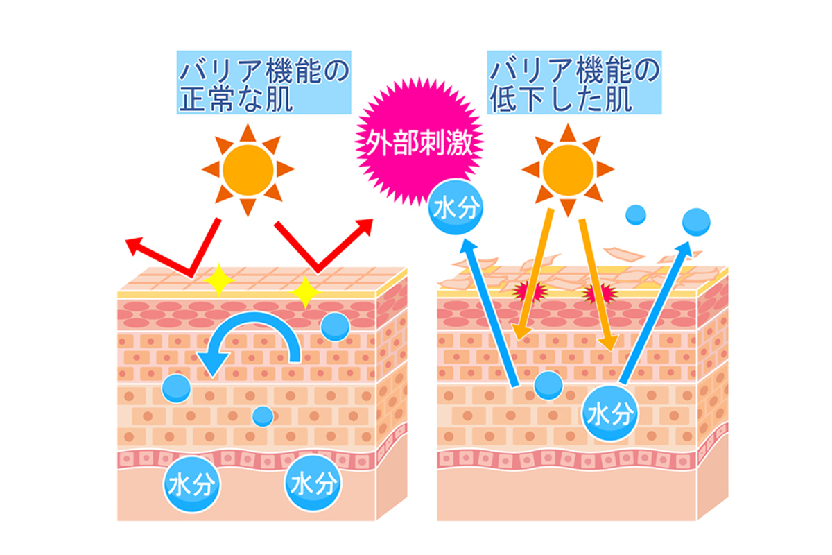 バリア機能の正常な肌と低下した肌の違いを肌の断面図で表したイラスト。正常な肌は水分が肌内部にとどまり太陽からの外部刺激をブロックしている。一方、低下した肌は太陽からの外部刺激によってダメージを受け、肌内部の水分も外に逃げている様子。