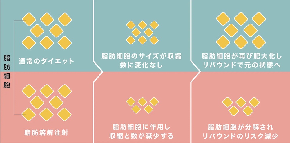 脂肪溶解注射の太ももへの効果は？必要な回数や費用について解説