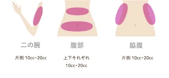 脂肪溶解注射はお腹に何cc打てば効果がある？おすすめの量と気をつけたいポイント