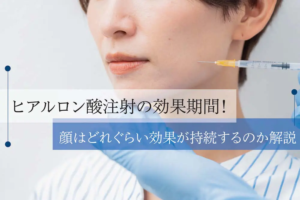 ヒアルロン酸注射の効果期間！顔はどれぐらい効果が持続するのか解説