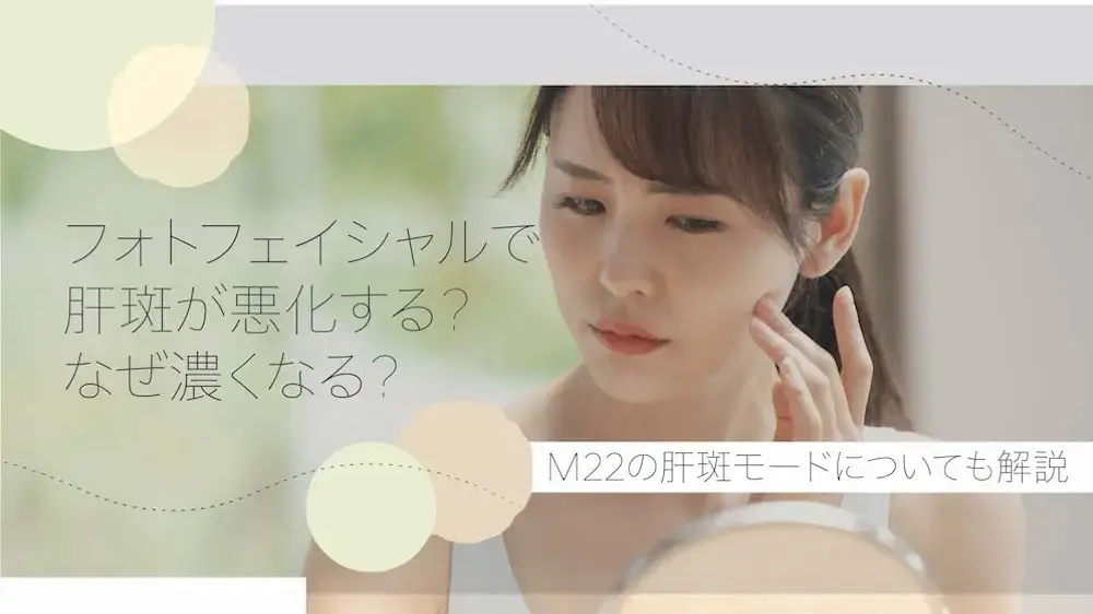 フォトフェイシャルで肝斑が悪化？なぜ濃くなる？M22の肝斑モードも解説