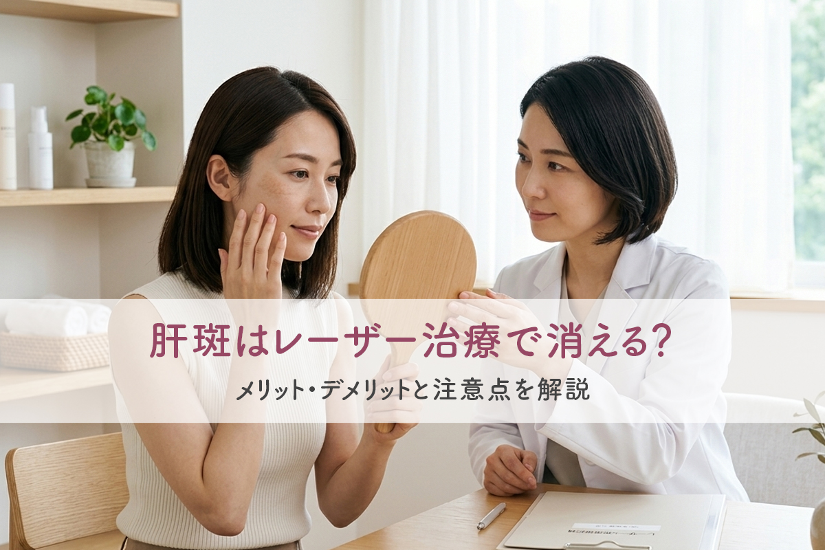 美容クリニックで手鏡を見ながら頬の状態を確認し、女性医師からレーザー治療の説明を受ける女性。「肝斑はレーザー治療で消える？メリット・デメリットと注意点を解説」というタイトルの入った美容医療コラムのメインビジュアル。