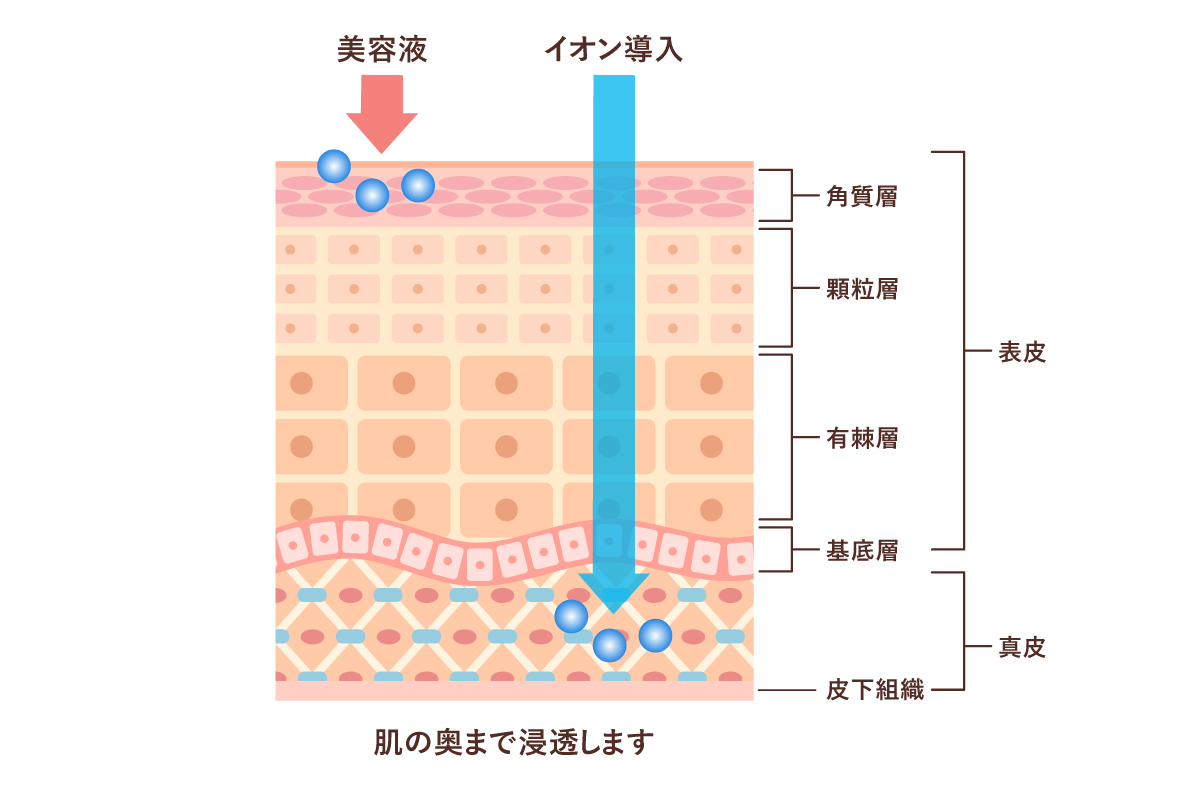 肌の断面図で美容液とイオン導入の浸透の深さの違いを示したイラスト。美容液が角質層までの浸透に対し、イオン導入は真皮層まで浸透することを表している。
