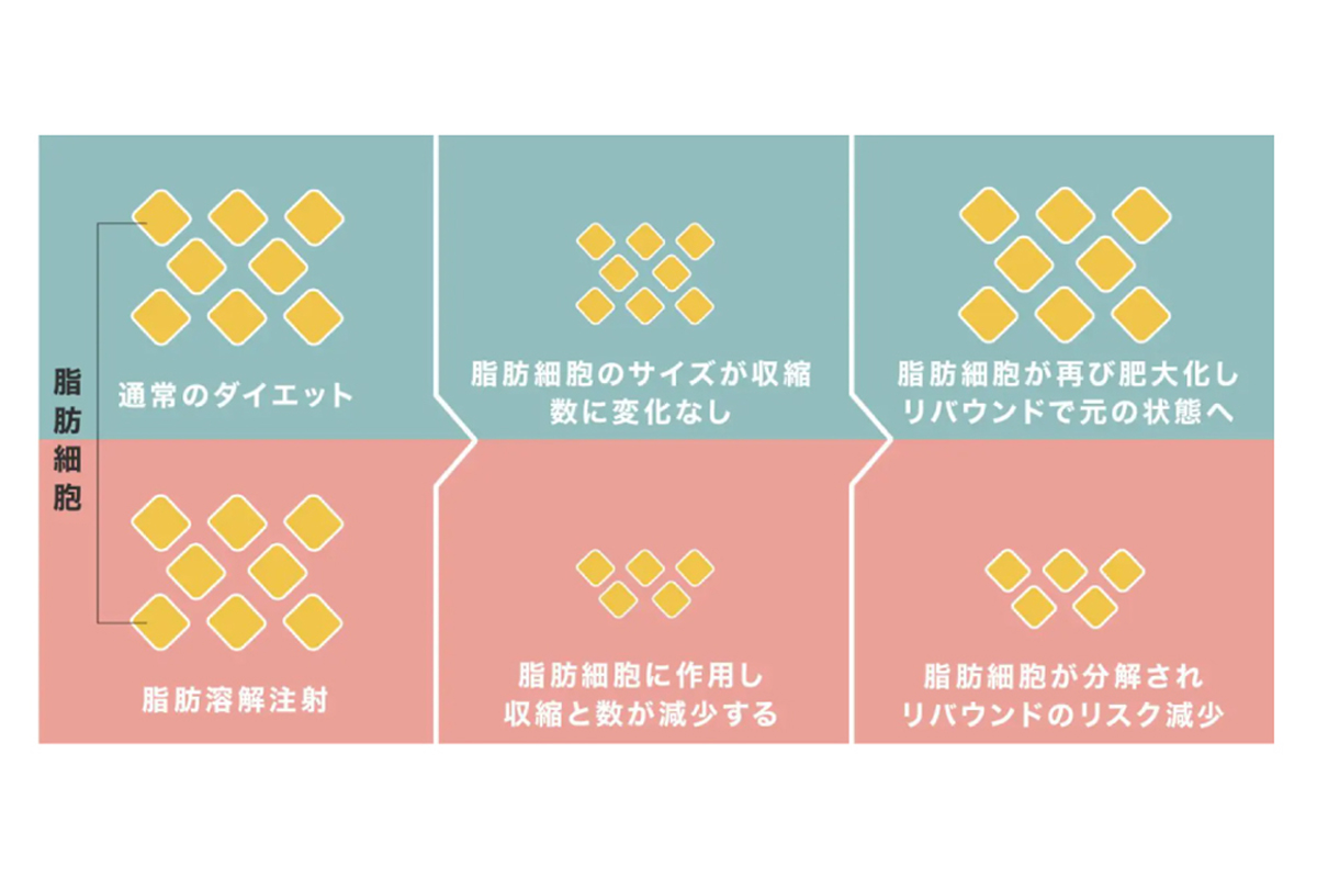 皮膚の下に薬剤を注射すると、脂肪細胞が反応して溶け出す様子を示した図。左側では注射針から薬剤が脂肪層に入り、黄色い脂肪細胞が青く広がる薬剤に包まれて溶解していく過程を描いている。右側では、溶けた脂肪細胞が体外へ排出され、脂肪層が薄くなり“脂肪が減少”と示されている。