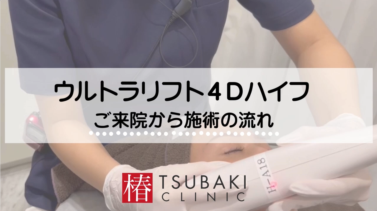 ウルトラリフト4D 医療ハイフ - 銀座・名古屋・心斎橋の美肌治療は椿 