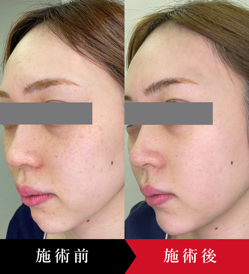 ゼオスキン ZO® SKIN HEALTH