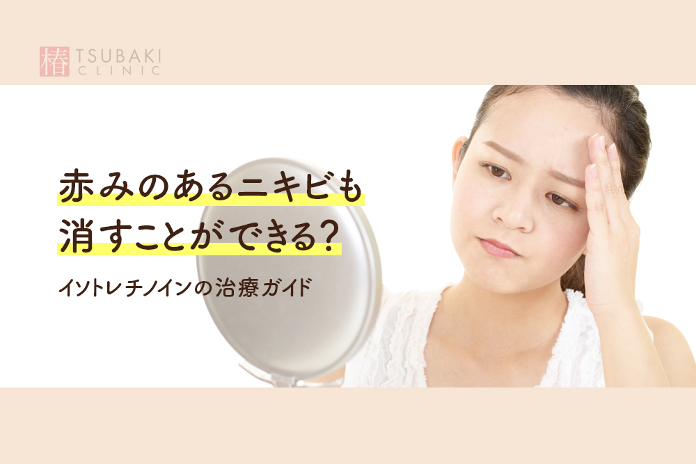 赤みのあるニキビも消すことができる？イソトレチノインの治療ガイド