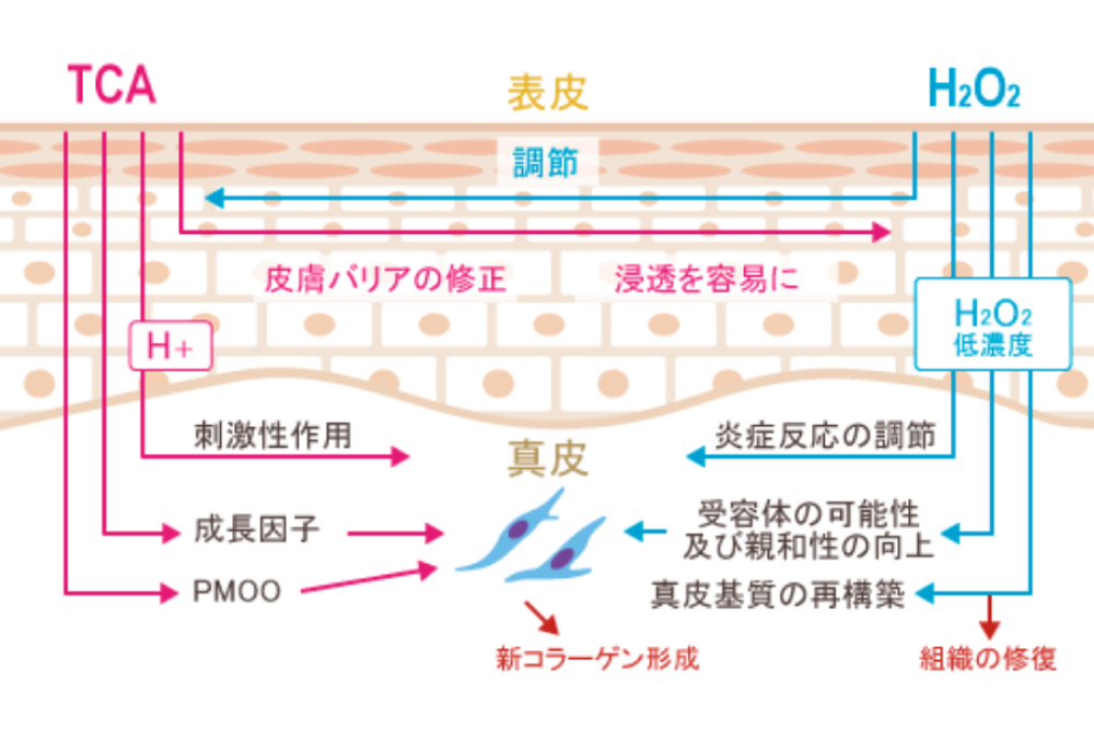 マッサージピールとは