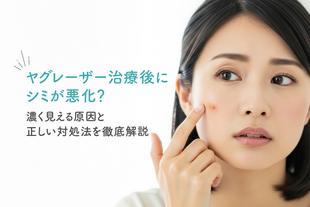 ヤグレーザー治療後にシミが悪化？濃く見える原因と正しい対処法を徹底解説