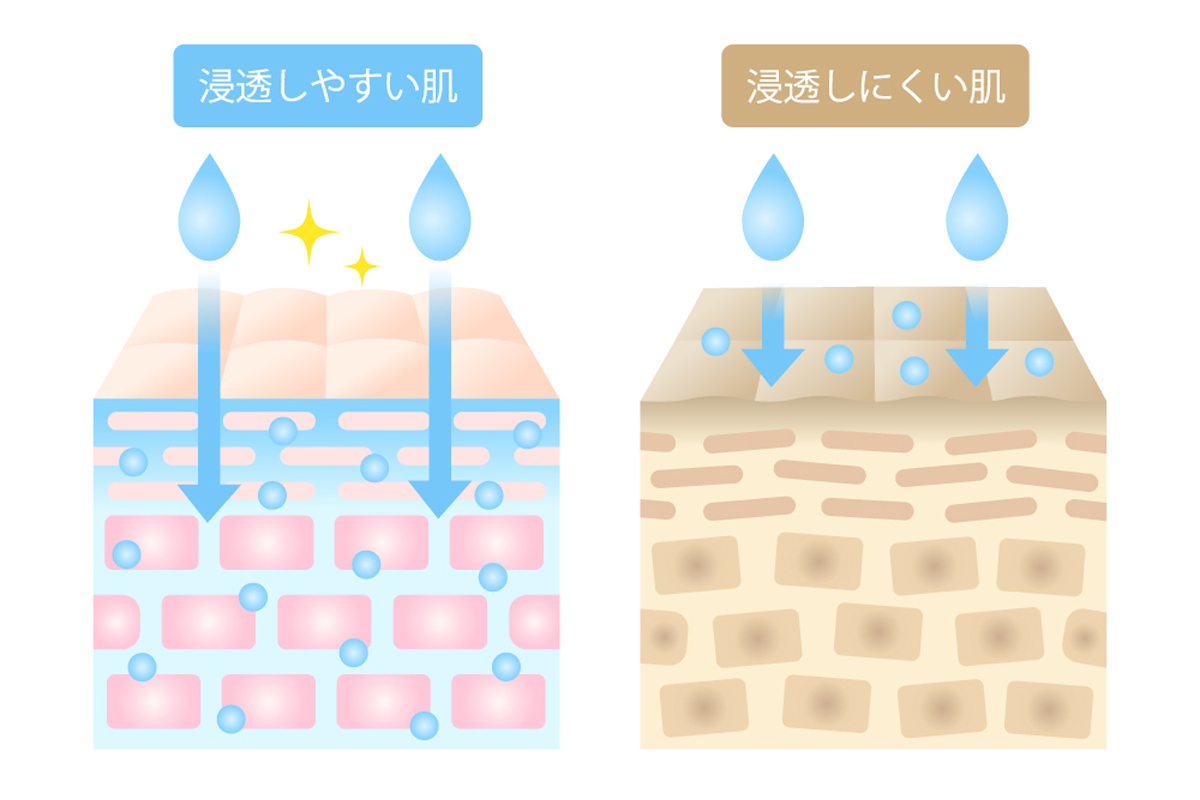 肌の断面図のイラストが2つ並んでおり、一方は水分が浸透しやすく肌の内部の角質層が潤っている状態を示している。もう一方は角質肥厚を起こし水分が浸透しにくく、角質層が乾燥してごわごわした状態を示している。