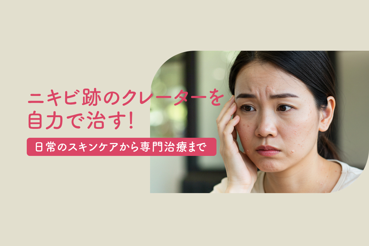 ニキビ跡のクレーターを自力で治す！日常のスキンケアから専門治療まで