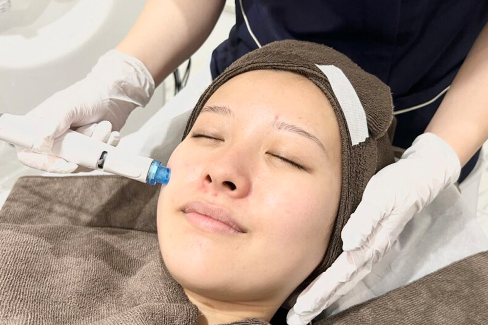 セルフケアに限界を感じたら？美容医療で毛穴の奥をリセット