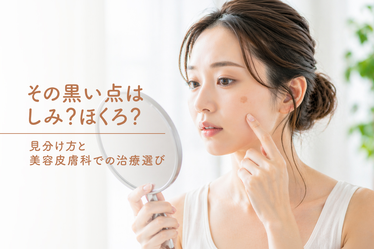 その黒い点はしみ？ほくろ？見分け方と美容皮膚科での治療選び