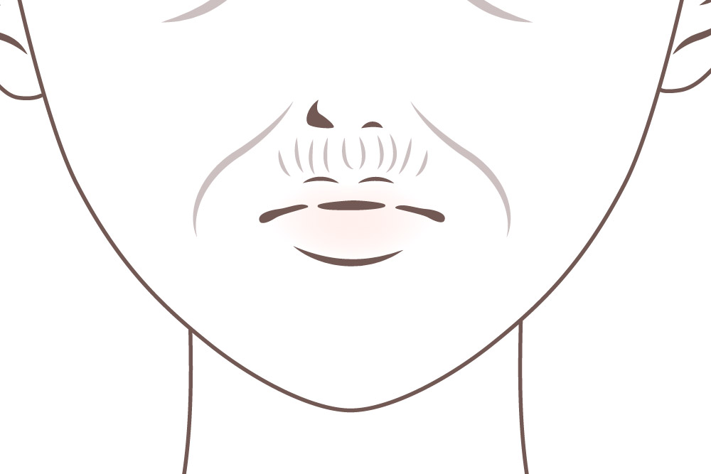 口周りの乾燥による小じわ
