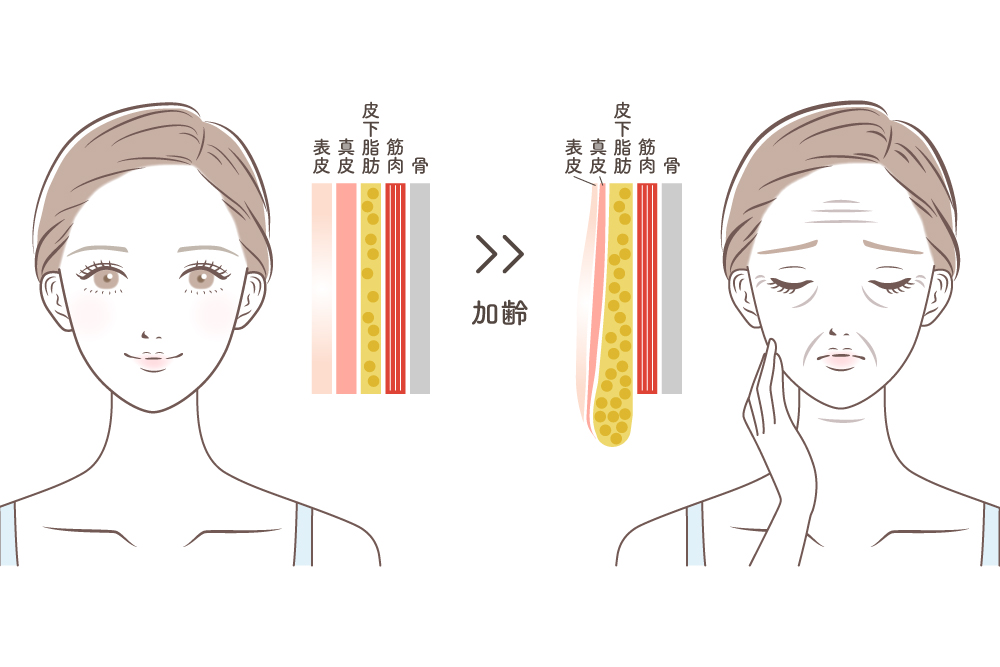 若々しい女性の顔と、口元や頬のたるみ・ほうれい線が目立つ年配の女性の顔を並べ、中央に皮膚・脂肪・筋肉・骨の縦の断面図を配置して、加齢による顔の組織バランスの変化を示したイラスト