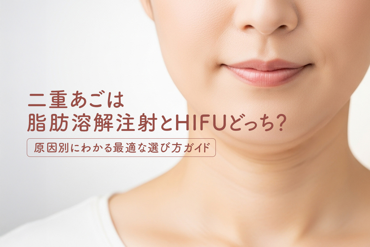 二重あごは脂肪溶解注射とHIFUどっち？原因別にわかる最適な選び方ガイド