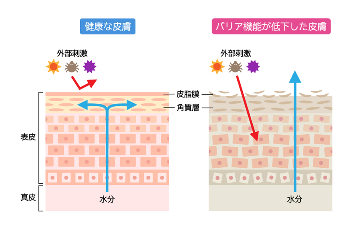 健康な皮膚とバリア機能の低下した皮膚の断面図のイラストが並んでおり、バリア機能が低下することで外部刺激を受けやすく、肌内部の水分が蒸発しやすくなる状態を示している。