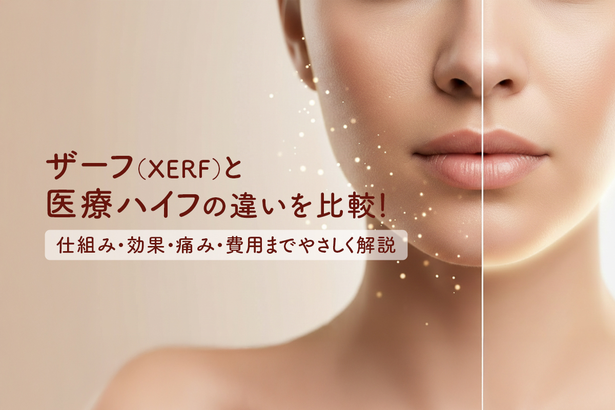 ザーフ（XERF）と医療ハイフの違いを比較！仕組み・効果・痛み・費用までやさしく解説