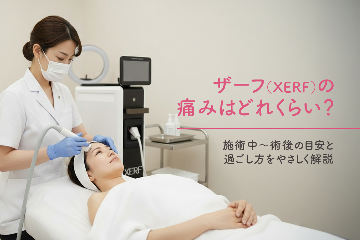 ザーフ（XERF）の痛みはどれくらい？施術中〜術後の目安と過ごし方をやさしく解説