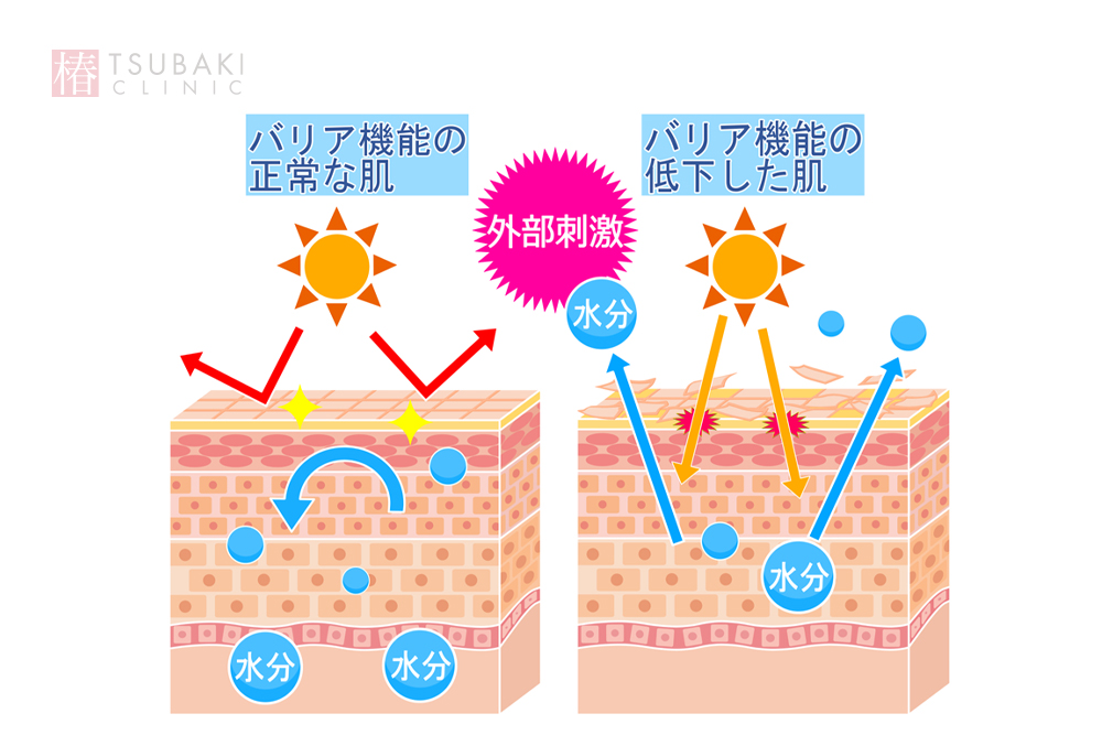 バリア機能の正常な肌と低下した肌を並べて外部刺激の影響を表した肌断面のイラスト。