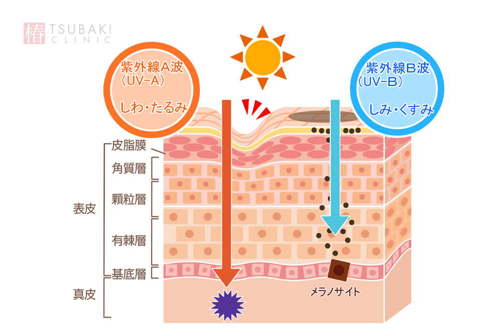 紫外線による肌への影響を表した肌断面のイラスト。UVAが真皮に到達しシワやたるみを起こす。UVBが表皮のメラノサイトを活性化させシミやくすみを引き起こす。