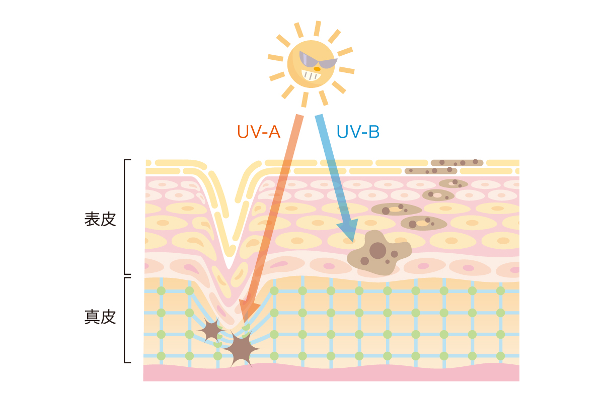 紫外線による肌への影響を表したイラスト。UVAが真皮層の構造を崩し、UVBが表皮からのメラニン生成を活発化させている。