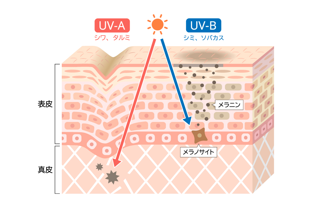 UVAが真皮層に到達しシワやたるみを、UVBが表皮でメラノサイトを活性化させシミやそばかすをそれぞれ引き起こすことを表した肌断面のイラスト。