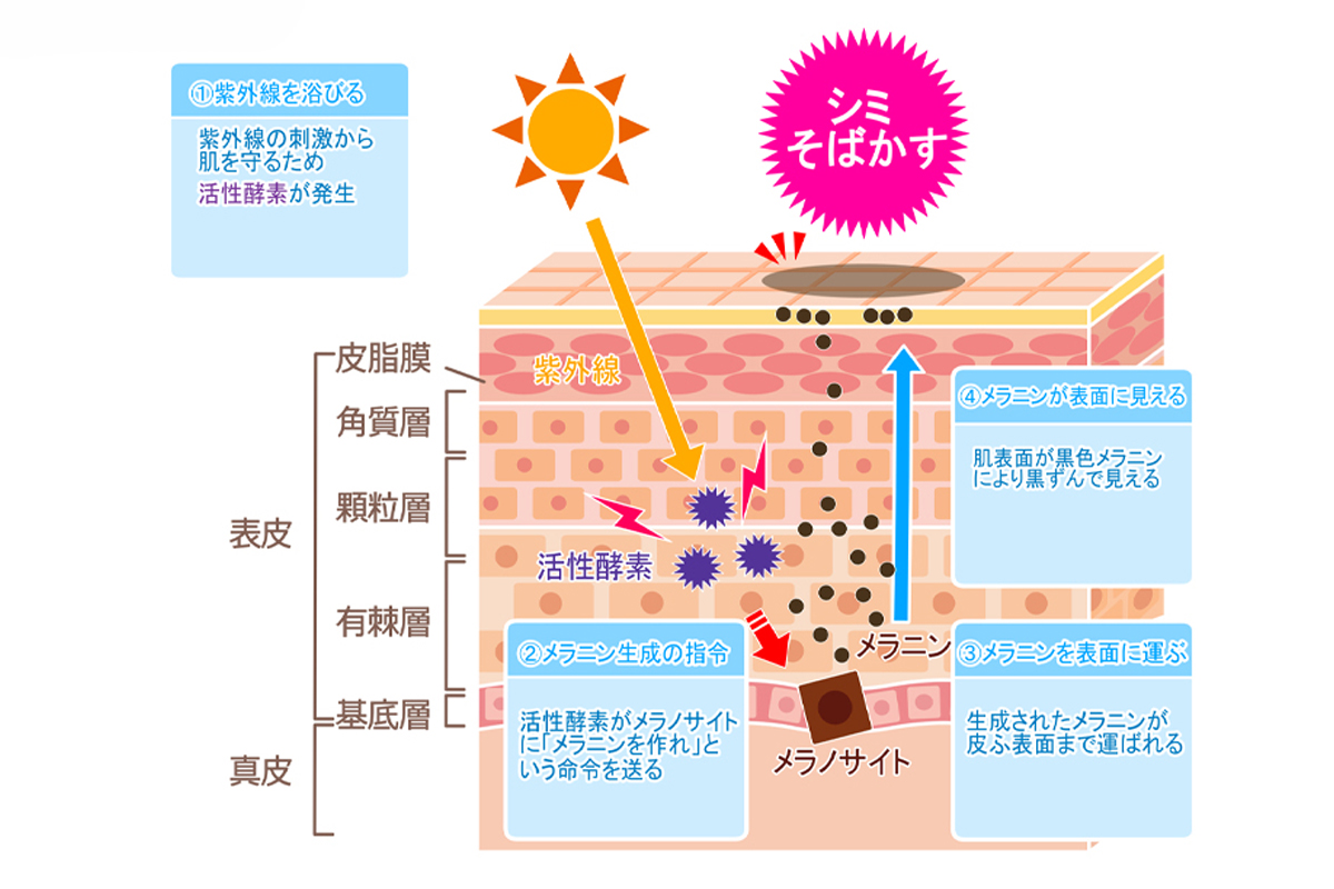 紫外線を浴びること肌内部でメラニン生成の指示が出され、メラニンが皮膚表面まで運ばれることでシミやそばかすなどの黒ずみが見えることを表した肌断面のイラスト。