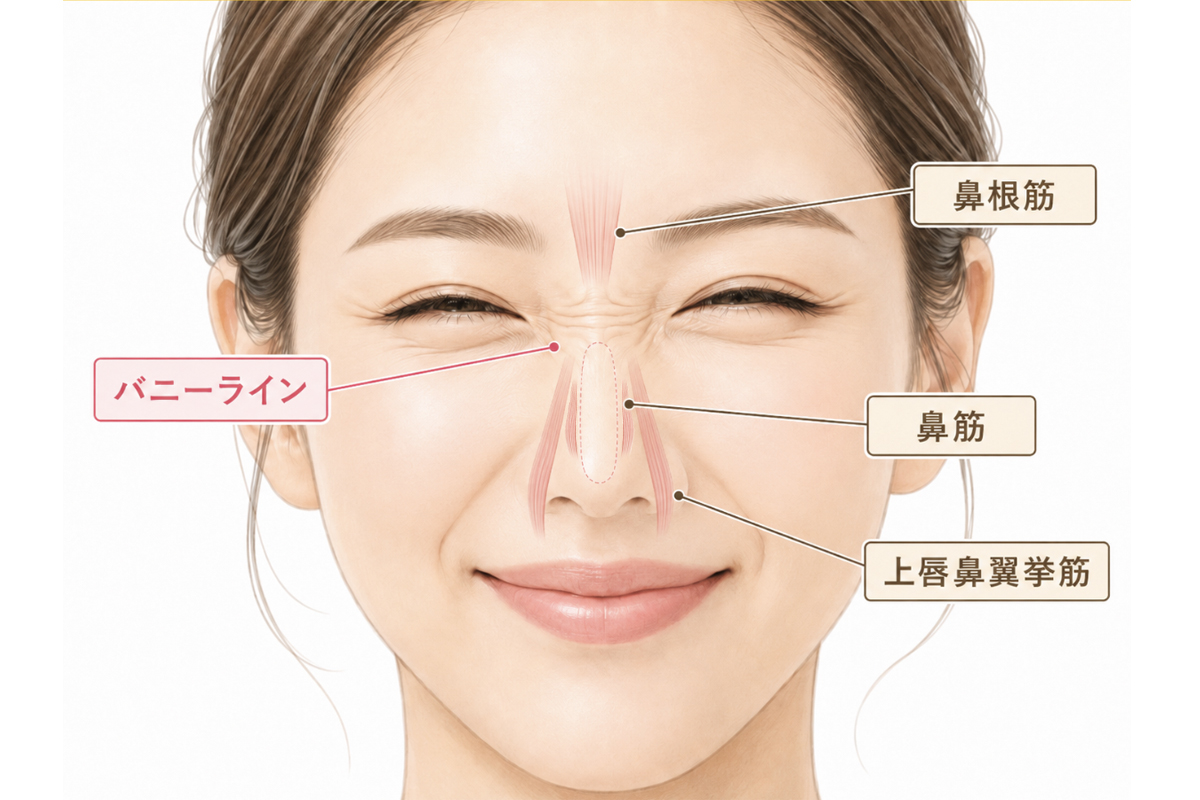 笑った女性の顔に、鼻の付け根にできる「バニーライン」と、鼻根筋・鼻筋・上唇鼻翼挙筋の位置がピンク色の線とラベルで示された解説イラスト。