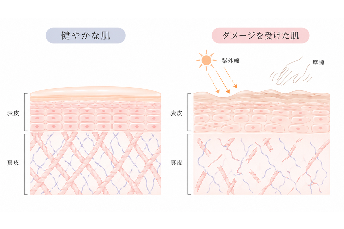 健やかな肌と紫外線・摩擦でダメージを受けた肌を比較し、真皮層のコラーゲンやエラスチンの変化を示したイラスト。