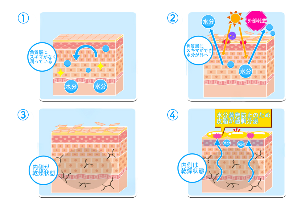 角質層に隙間がない潤った肌と、外部刺激や水分蒸発によって乾燥し皮脂が過剰分泌する肌の状態を比較したイラスト
